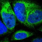 Immunofluorescent staining of human cell line A-431 shows localization to endoplasmic reticulum.