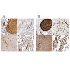 Anti-C4BPA Antibody