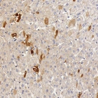Immunohistochemical staining of human liver shows moderate cytoplasmic positivity in hepatocytes.