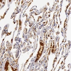 Immunohistochemical staining of human lung shows strong cytoplasmic positivity in macrophages.