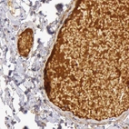 Immunohistochemical staining of human colon shows strong positivity in plasma.