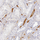 Anti-C4BPA Antibody