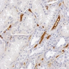 Immunohistochemical staining of human kidney shows strong positivity in plasma.