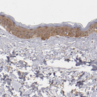 Anti-EFS Antibody