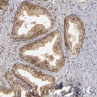 Immunohistochemical staining of human prostate shows strong cytoplasmic positivity in glandular cells.