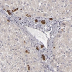 Immunohistochemical staining of human liver shows strong cytoplasmic positivity in bile duct cells.