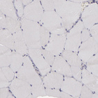 Immunohistochemical staining of human skeletal muscle shows no positivity in myocytes as expected.