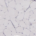 Immunohistochemical staining of human skeletal muscle shows no positivity in myocytes as expected.