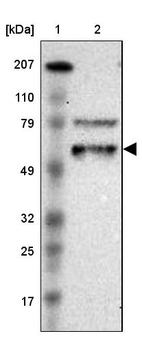 Lane 1: Marker [kDa] 207, 110, 79, 49, 32, 25, 17_br/_Lane 2: Human cell line RT-4