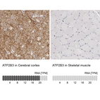 Anti-ATP2B3 Antibody