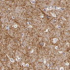 Anti-ATP2B3 Antibody