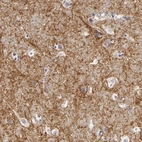 Immunohistochemical staining of human cerebral cortex shows moderate to strong positivity in neuronal processes.