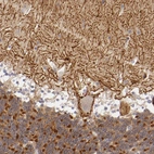Immunohistochemical staining of human cerebellum shows strong positivity in neuronal processes.