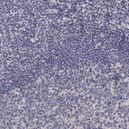 Anti-ATP2B3 Antibody