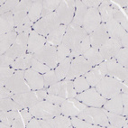 Anti-ATP2B3 Antibody