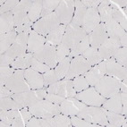 Immunohistochemical staining of human skeletal muscle shows no positivity in myocytes as expected.