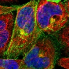 Immunofluorescent staining of human cell line A-431 shows localization to plasma membrane & the Golgi apparatus.