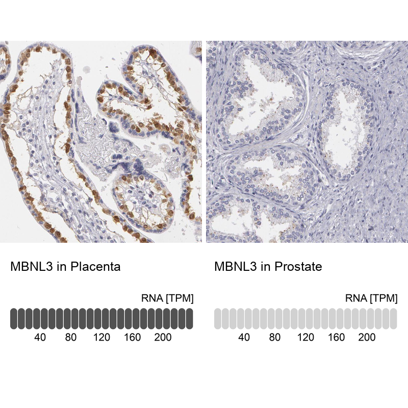 Anti-MBNL3 Antibody