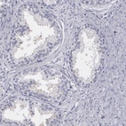Anti-MBNL3 Antibody