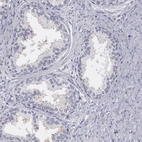 Immunohistochemical staining of human prostate shows low expression as expected.