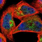 Immunofluorescent staining of human cell line A-431 shows localization to the Golgi apparatus & vesicles.