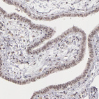 Immunohistochemical staining of human fallopian tube shows moderate nuclear positivity in glandular cells.