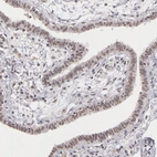 Immunohistochemical staining of human fallopian tube shows moderate nuclear positivity in glandular cells.