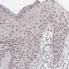 Immunohistochemical staining of human skin shows strong nucleolar positivity in squamous epithelial cells.