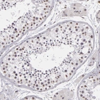 Immunohistochemical staining of human testis shows moderate nuclear positivity in a subset of cells in seminiferous ducts.