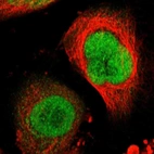 Immunofluorescent staining of human cell line U-251 MG shows localization to nucleus.