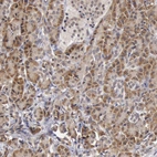Anti-SYTL4 Antibody