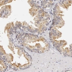 Immunohistochemical staining of human prostate shows weak to moderate cytoplasmic positivity in glandular cells.