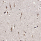Immunohistochemical staining of human cerebral cortex shows weak to moderate cytoplasmic positivity in neurons.