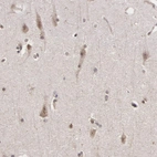 Immunohistochemical staining of human cerebral cortex shows weak to moderate cytoplasmic positivity in neurons.