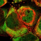 Immunofluorescent staining of human cell line A-431 shows localization to nucleoplasm, cytosol & microtubule organizing center.