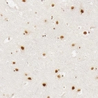Immunohistochemical staining of human cerebral cortex shows moderate to strong nuclear positivity in neurons.