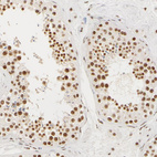 Anti-RBM39 Antibody