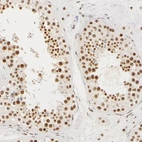 Immunohistochemical staining of human testis shows moderate to strong nuclear positivity in cells in seminiferous ducts.