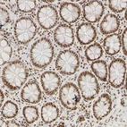 Immunohistochemical staining of human colon shows strong nuclear positivity in glandular cells.