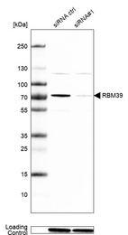 Anti-RBM39 Antibody