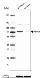 Western blot analysis in Caco-2 cells transfected with control siRNA, target specific siRNA probe #1, using Anti-RBM39 antibody. Remaining relative intensity is presented. Loading control: Anti-GAPDH.