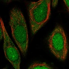 Immunofluorescent staining of human cell line SiHa shows localization to nucleus, nucleoli & cytosol.