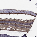 Anti-RPGR Antibody