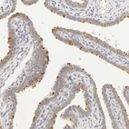 Immunohistochemical staining of human fallopian tube shows strong positivity in cilia in glandular cells.