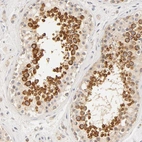 Immunohistochemical staining of human testis shows strong membranous and cytoplasmic positivity in cells in seminiferous ducts.