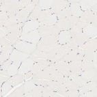 Immunohistochemical staining of human skeletal muscle shows no cytoplasmic positivity in myocytes as expected.