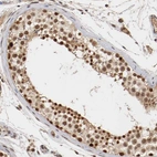 Immunohistochemical staining of human testis shows strong nuclear positivity in cells in seminiferous ducts.