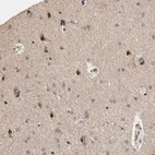 Immunohistochemical staining of human cerebral cortex shows strong nuclear positivity in a subset of neurons.