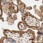 Immunohistochemical staining of human placenta shows strong nuclear positivity in trophoblastic cells.