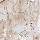 Immunohistochemical staining of human skeletal muscle shows weak cytoplasmic positivity in myocytes.